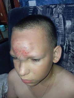 Жестокое избиение 11-летнего мальчика в Нижегородской области